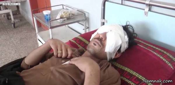 در آوردن چشم پسر جوان