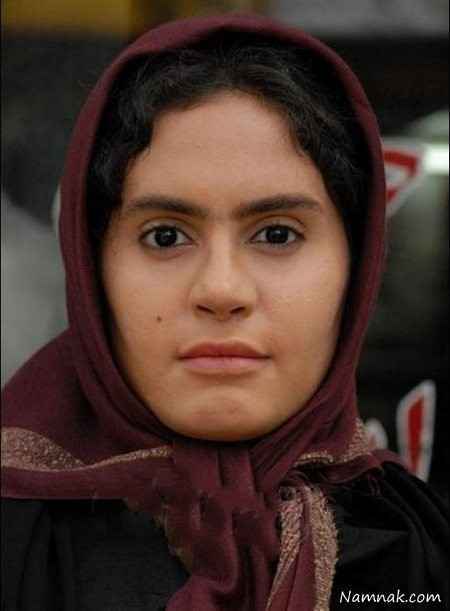 الناز شاکر دوست قبل از عمل  عکس