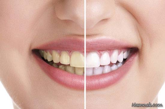 سوال های متداول آرایشی