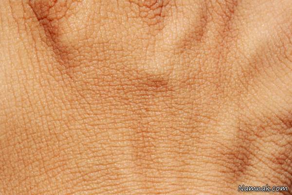 پوست انسان ها 