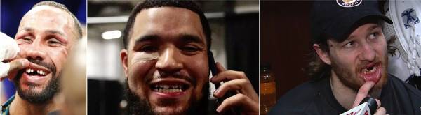 جرمگیری دندان چیست سرطان دهان