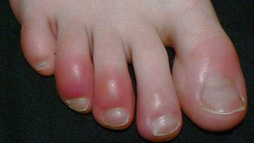 علائم جدید کرونا ویروس