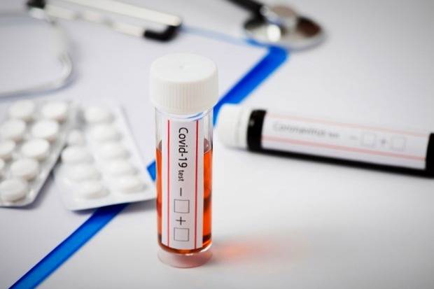 توضیحات مهم درباره تست کرونا و منفی شدن آن منفی شدن تست کرونا