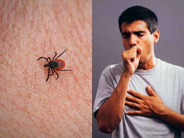 sfts virus انتشار ویروس SFTS