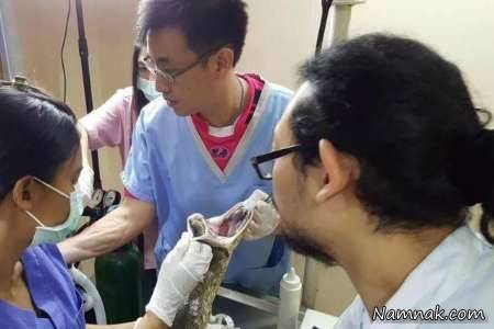 عمل جراحی مار آناکوندا تومور قلبی