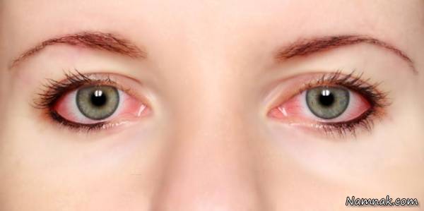 چکاپ سلامتی