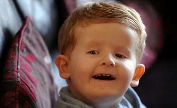 معنی کودکان کریستالی چیست؟