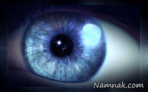 میخ در چشم