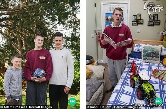 بیماری مادرزادی