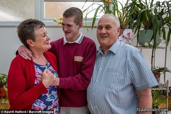 بیماری مادرزادی