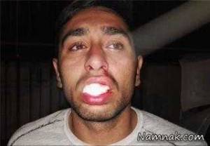 درگیری شدید