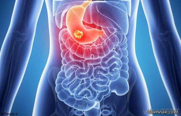 صداهای ناهنجار معده ناشی از چیست