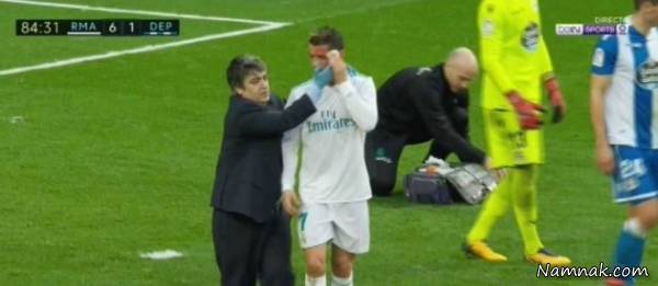 مصدومیت خونین کریستیانو رونالدو مقابل دپورتیوو مصدومیت کریستیانو رونالدو