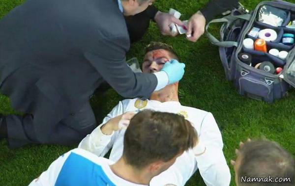 مصدومیت خونین کریستیانو رونالدو مقابل دپورتیوو مصدومیت کریستیانو رونالدو