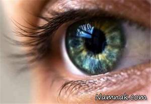 فشار چشم