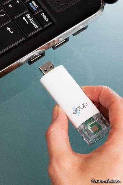 تشخیص بیماری اچ آی وی با یو اس بی اچ آی وی