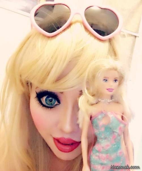 جراحی باربی