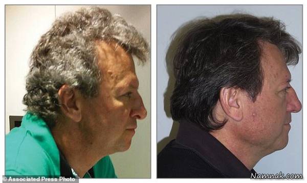 داروی ضد سرطان