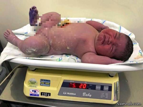 تولد نوزاد بزرگ 