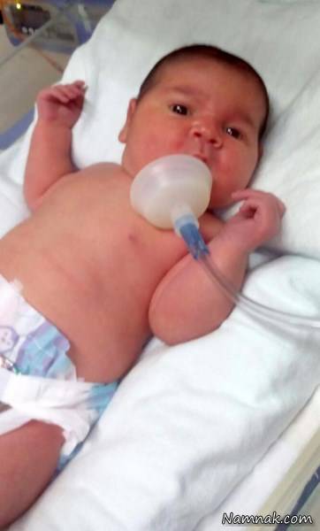 تولد نوزاد بزرگ 