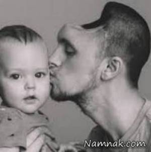 مرد بدون جمجمه