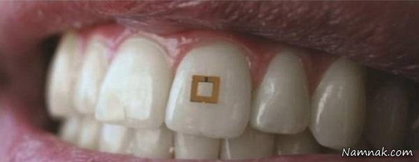 حسگر ضد چاقی