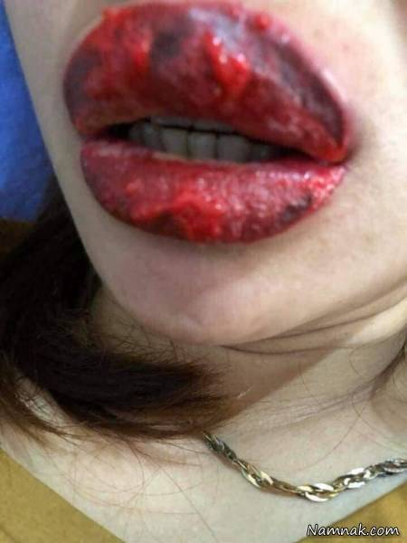 رژلب تقلبی