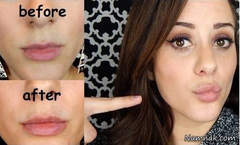 برجستگی لبها